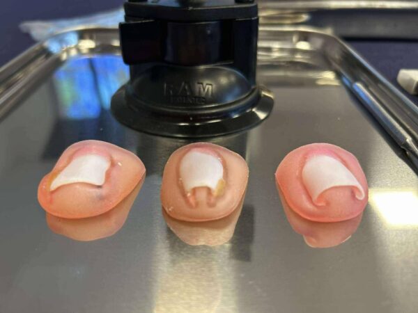 Trois modèles d’ongles pathologiques utilisés pendant les formations Pediform