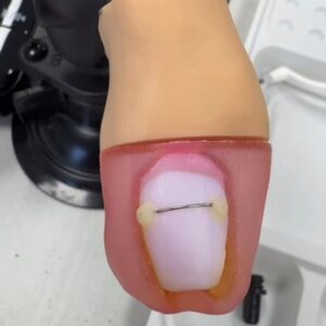 Simulateur pédagogique utilisé pour la pratique de l’orthonyxie